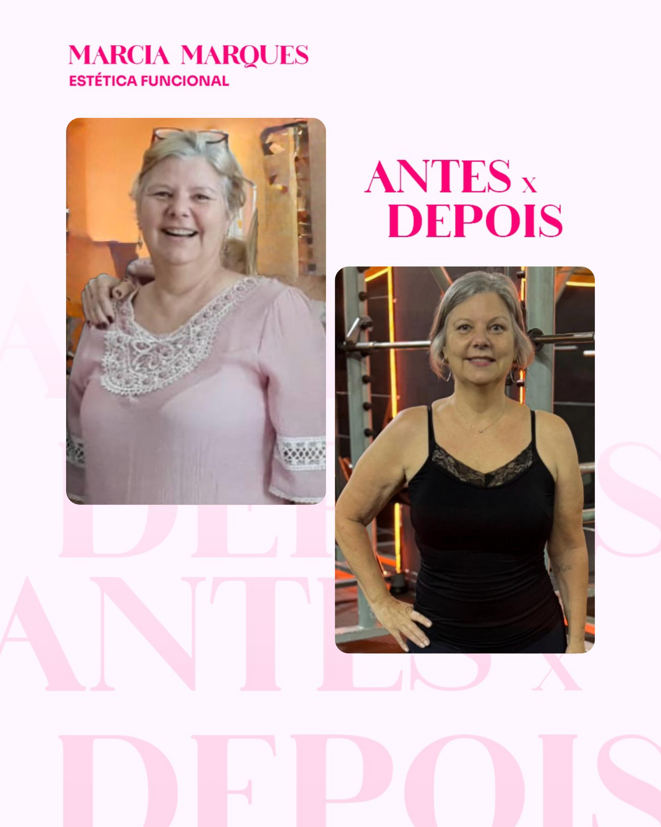 Antes e Depois 4